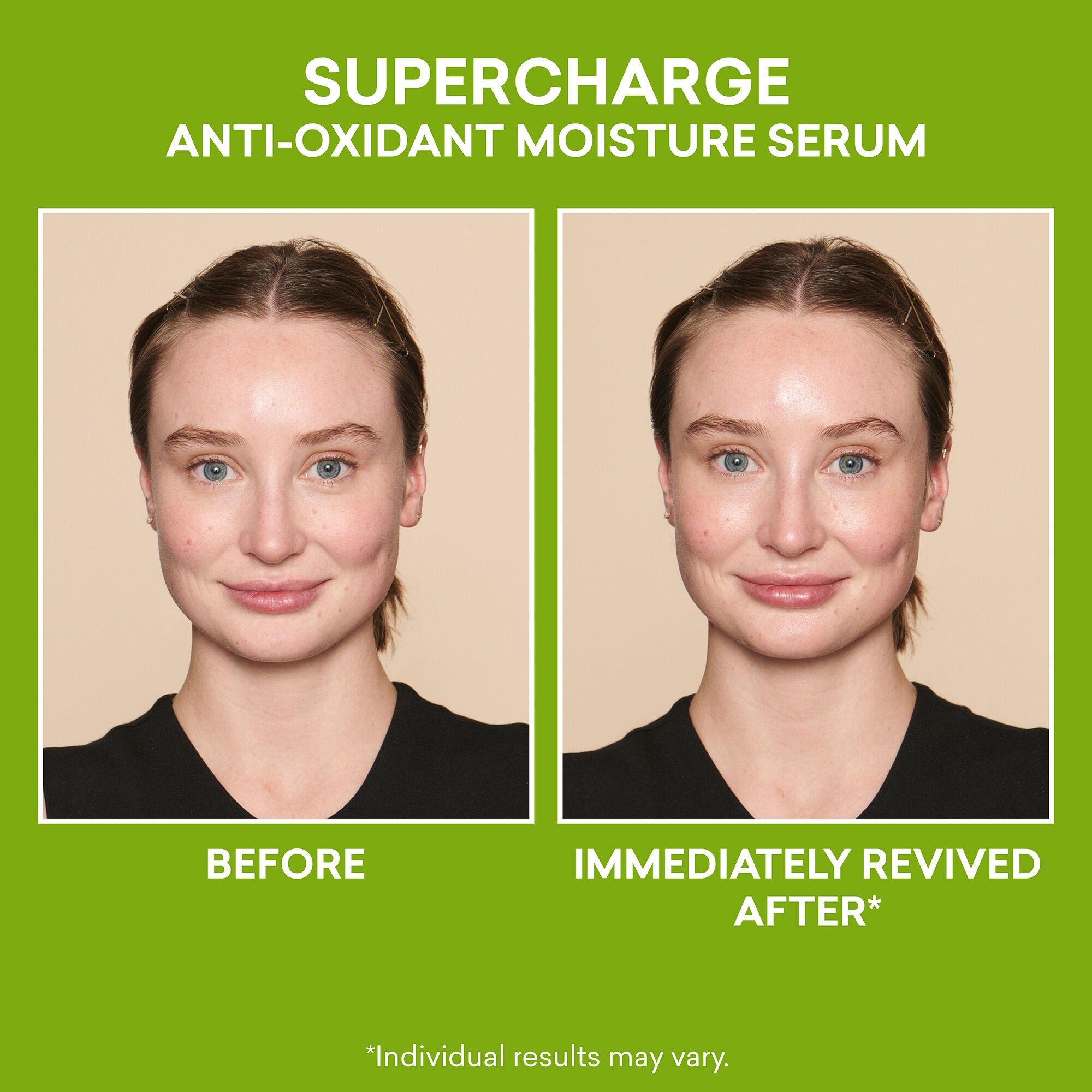 Supercharge Anti-Oxidant Moisture Serum|30 ml / 1.0 fl oz